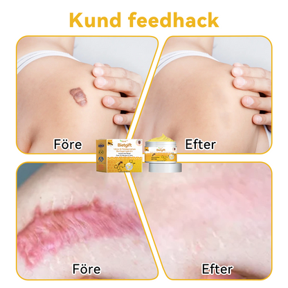 🔥Bara 4 lådor kvar! Vi erbjuder dig ytterligare 50% rabatt! Dermatologiskt testad, 4-6 flaskor räcker för att helt reparera din hud utan återfall. Missa inte och vänta ytterligare ett år 💥