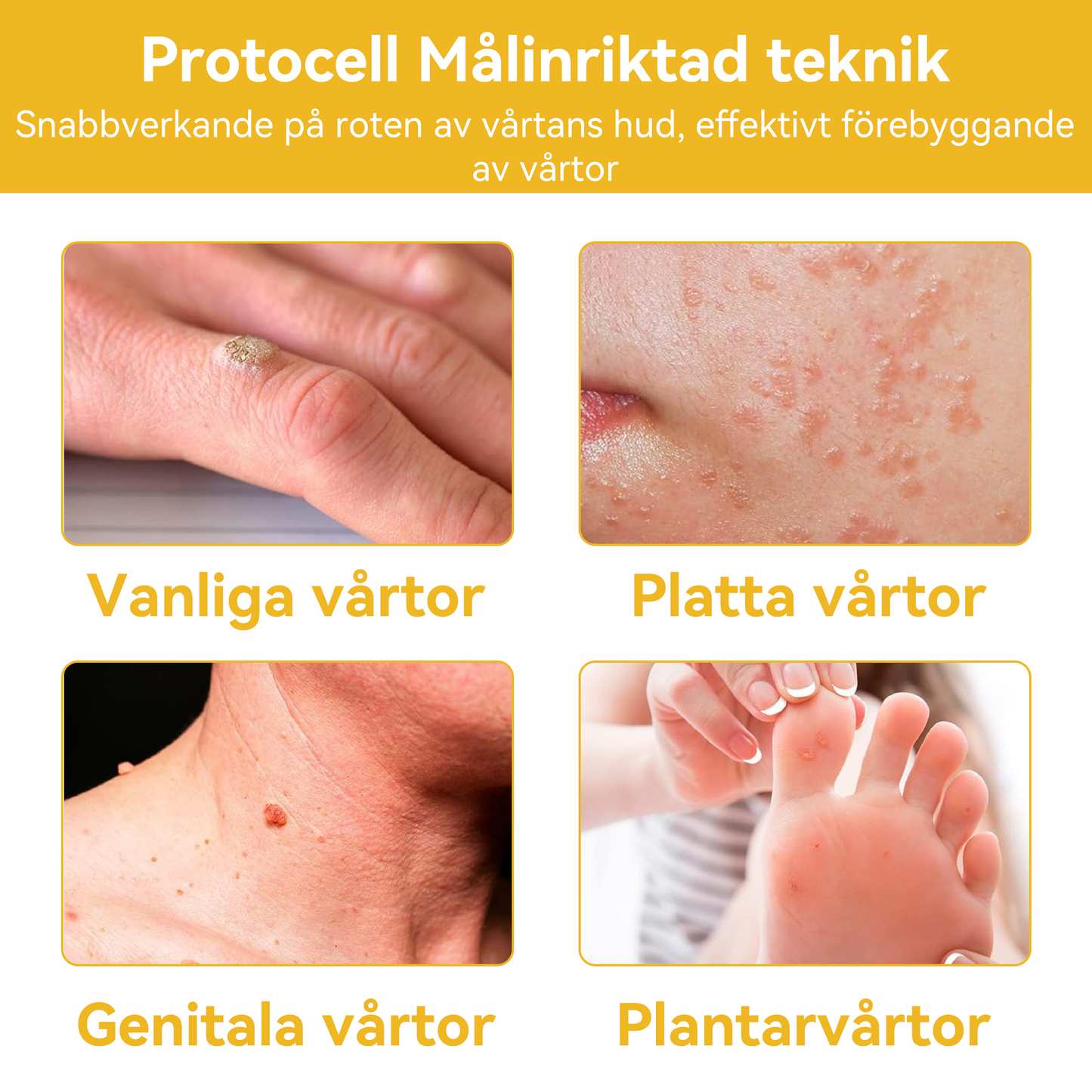 🔥Bara 4 lådor kvar! Vi erbjuder dig ytterligare 50% rabatt! Dermatologiskt testad, 4-6 flaskor räcker för att helt reparera din hud utan återfall. Missa inte och vänta ytterligare ett år 💥