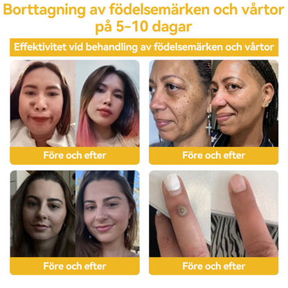 🔥Bara 4 lådor kvar! Vi erbjuder dig ytterligare 50% rabatt! Dermatologiskt testad, 4-6 flaskor räcker för att helt reparera din hud utan återfall. Missa inte och vänta ytterligare ett år 💥