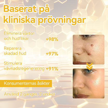 🔥Bara 4 lådor kvar! Vi erbjuder dig ytterligare 50% rabatt! Dermatologiskt testad, 4-6 flaskor räcker för att helt reparera din hud utan återfall. Missa inte och vänta ytterligare ett år 💥