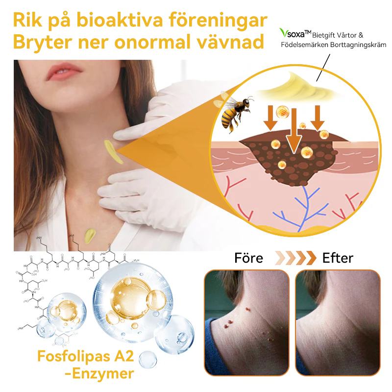 🔥Bara 4 lådor kvar! Vi erbjuder dig ytterligare 50% rabatt! Dermatologiskt testad, 4-6 flaskor räcker för att helt reparera din hud utan återfall. Missa inte och vänta ytterligare ett år 💥