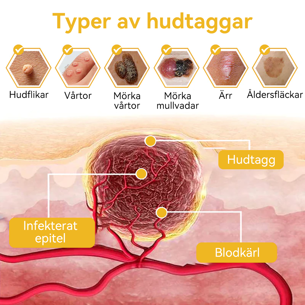 🔥Bara 4 lådor kvar! Vi erbjuder dig ytterligare 50% rabatt! Dermatologiskt testad, 4-6 flaskor räcker för att helt reparera din hud utan återfall. Missa inte och vänta ytterligare ett år 💥