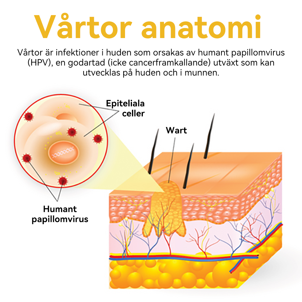 🔥Bara 4 lådor kvar! Vi erbjuder dig ytterligare 50% rabatt! Dermatologiskt testad, 4-6 flaskor räcker för att helt reparera din hud utan återfall. Missa inte och vänta ytterligare ett år 💥