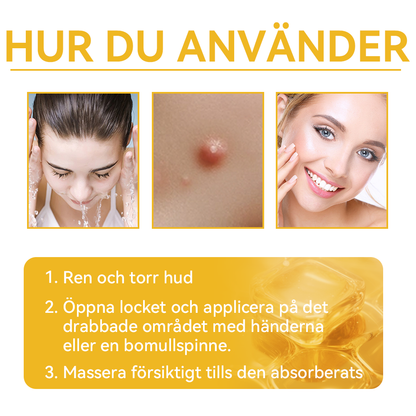 🔥Bara 4 lådor kvar! Vi erbjuder dig ytterligare 50% rabatt! Dermatologiskt testad, 4-6 flaskor räcker för att helt reparera din hud utan återfall. Missa inte och vänta ytterligare ett år 💥