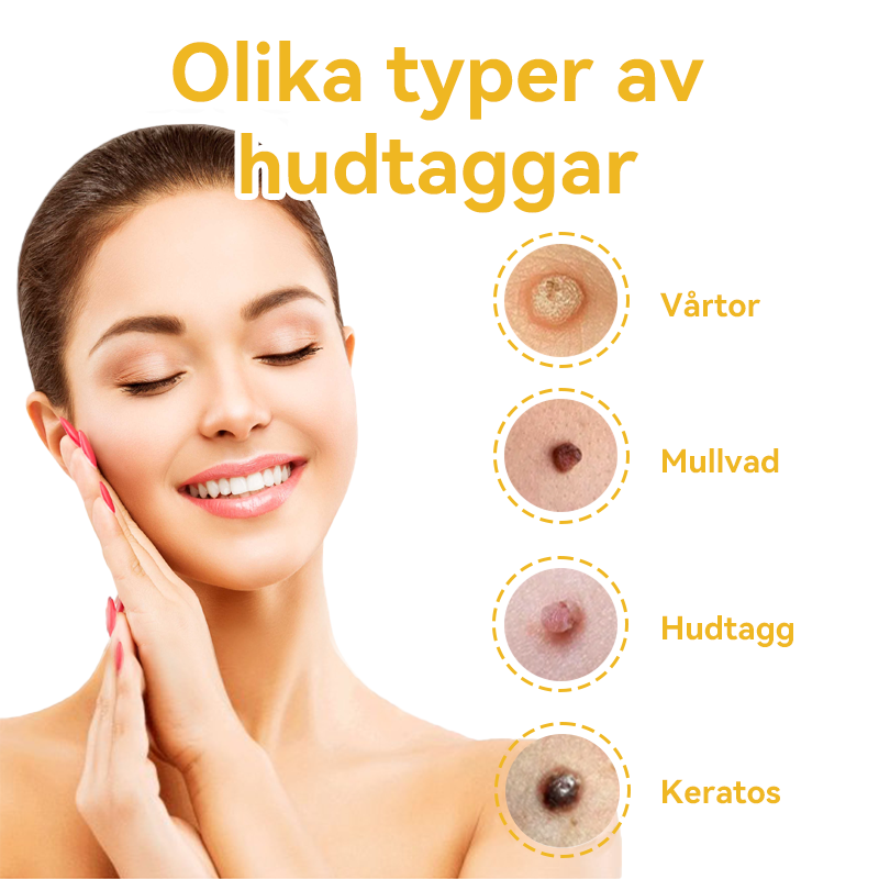 🔥Bara 4 lådor kvar! Vi erbjuder dig ytterligare 50% rabatt! Dermatologiskt testad, 4-6 flaskor räcker för att helt reparera din hud utan återfall. Missa inte och vänta ytterligare ett år 💥