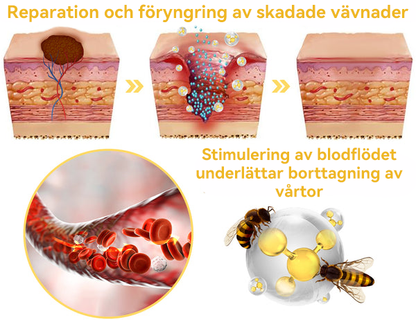 🔥Bara 4 lådor kvar! Vi erbjuder dig ytterligare 50% rabatt! Dermatologiskt testad, 4-6 flaskor räcker för att helt reparera din hud utan återfall. Missa inte och vänta ytterligare ett år 💥