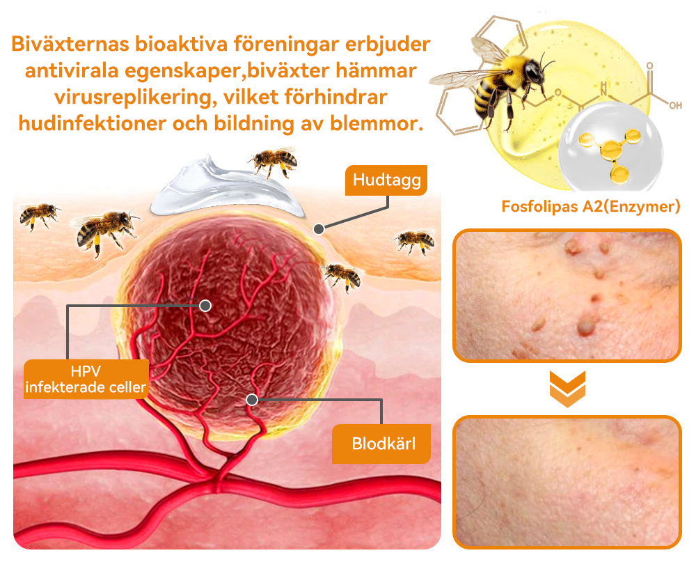 🔥Bara 4 lådor kvar! Vi erbjuder dig ytterligare 50% rabatt! Dermatologiskt testad, 4-6 flaskor räcker för att helt reparera din hud utan återfall. Missa inte och vänta ytterligare ett år 💥