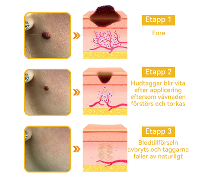 🔥Bara 4 lådor kvar! Vi erbjuder dig ytterligare 50% rabatt! Dermatologiskt testad, 4-6 flaskor räcker för att helt reparera din hud utan återfall. Missa inte och vänta ytterligare ett år 💥